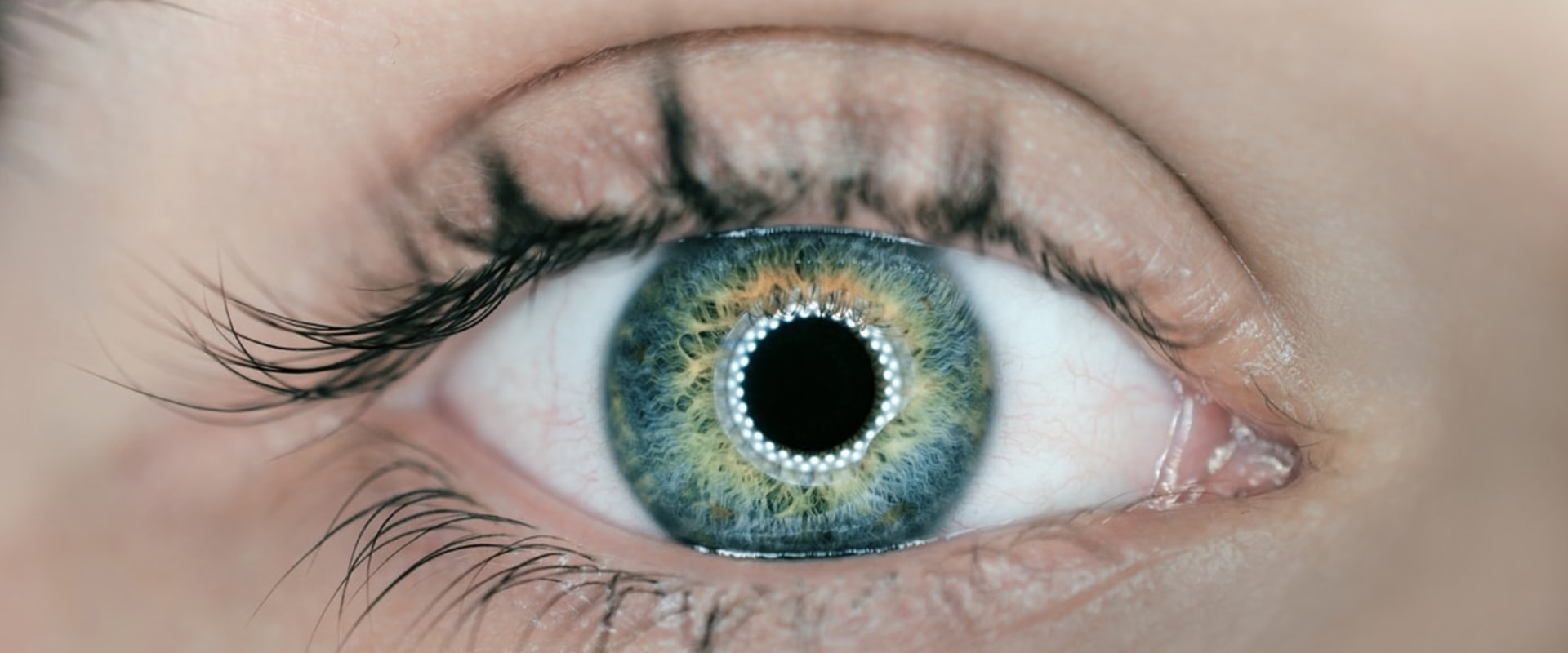 How Long Does Night Blindness Last After LASIK Surgery?