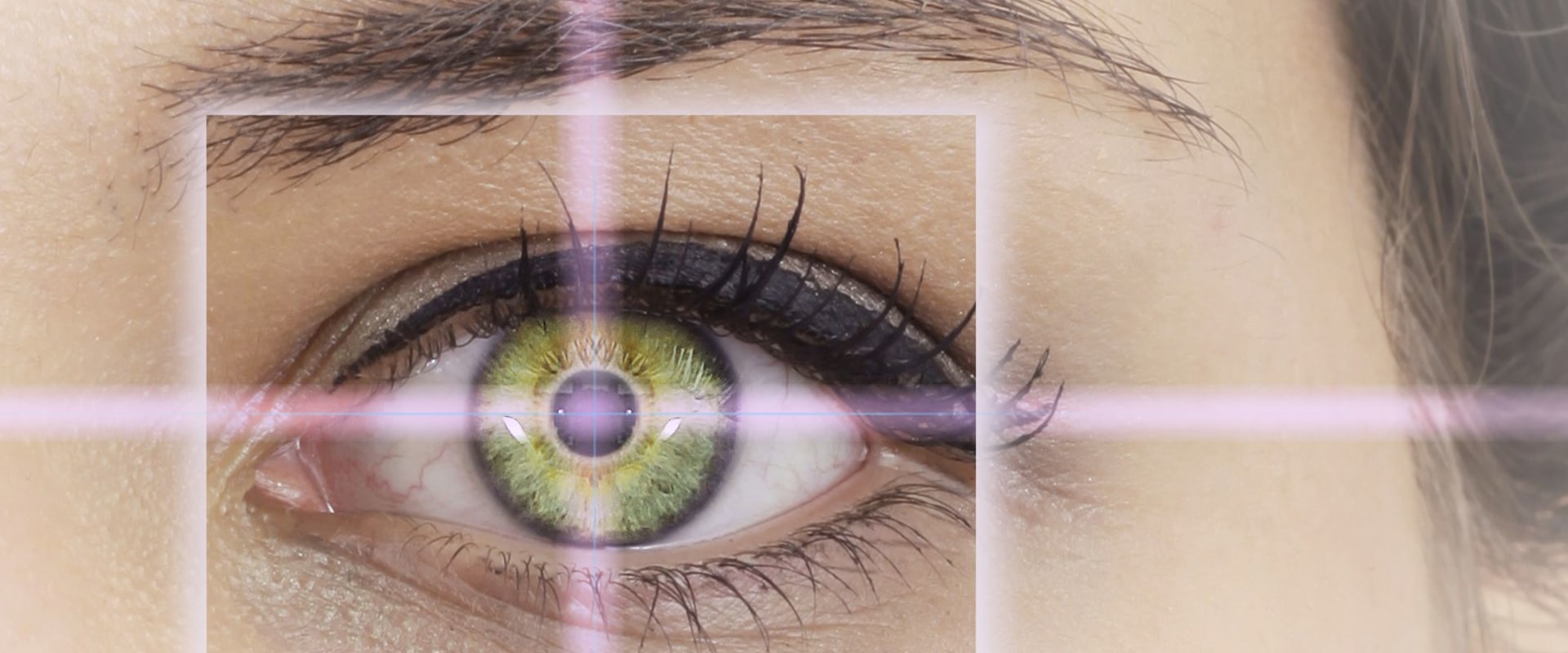 Does LASIK Surgery Last Forever?