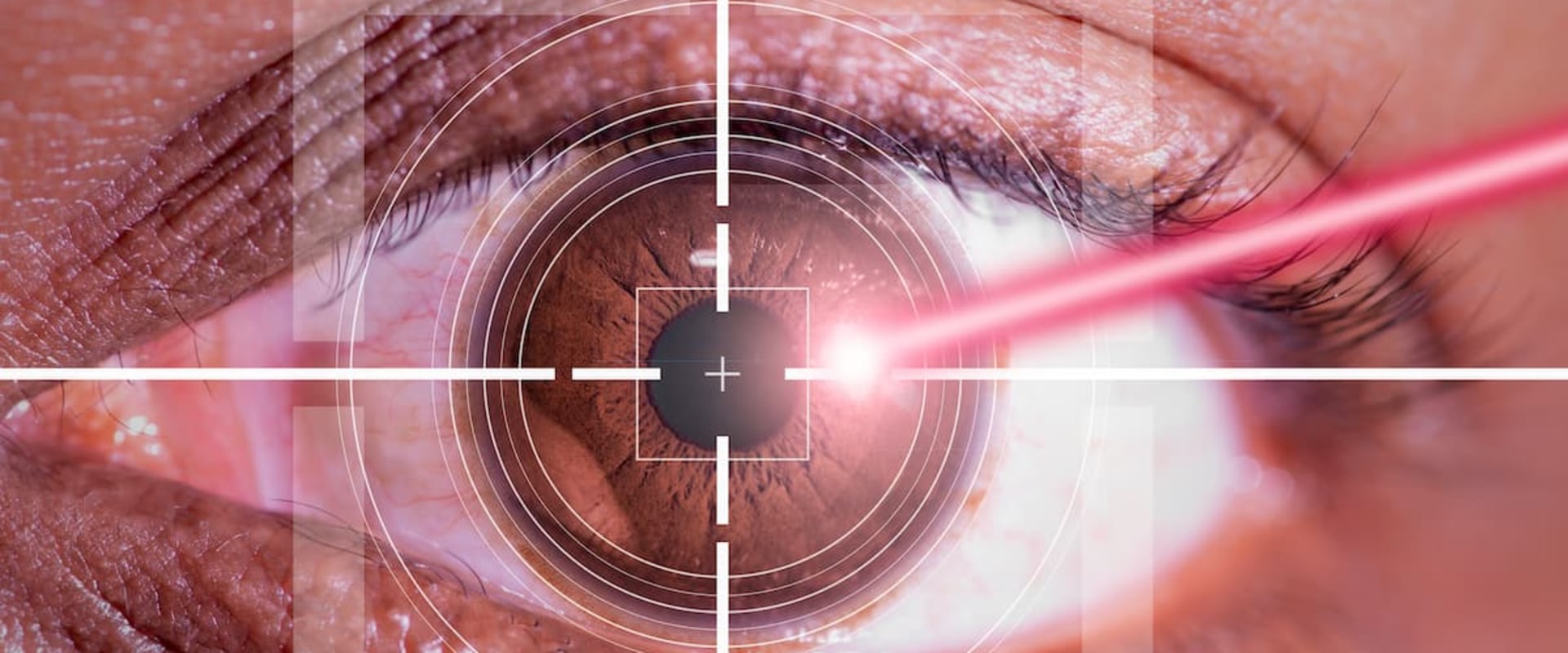 Is Lasik Surgery High Risk? An Expert's Perspective