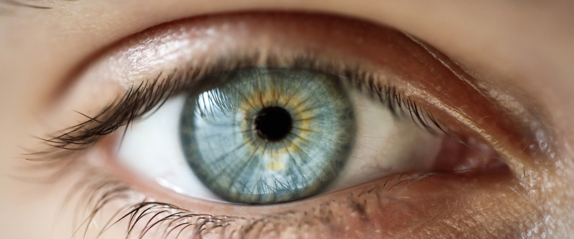 Can You Get LASIK Surgery if You Have Astigmatism?