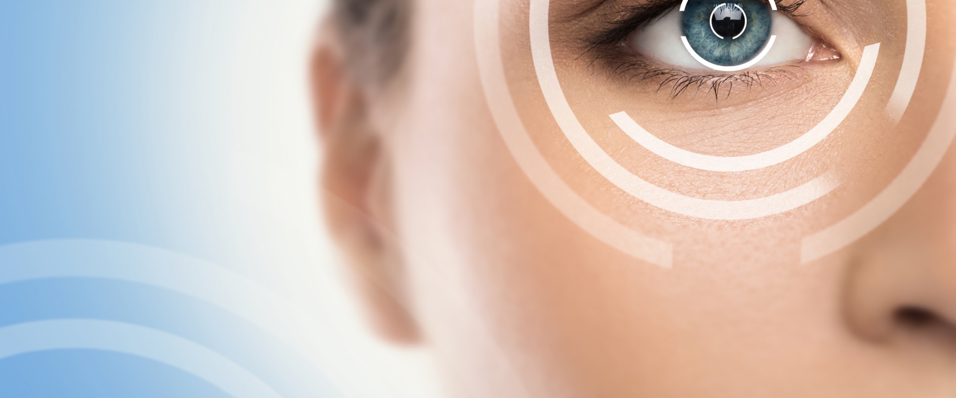 What Type of Anesthesia is Used During LASIK Eye Surgery?