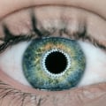 What are the Chances of LASIK Surgery Failing?