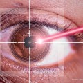 Is Lasik Surgery High Risk? An Expert's Perspective