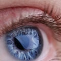 What Are the Risks of Infection After Lasik Eye Surgery?
