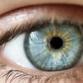 Can You Get LASIK Surgery if You Have Astigmatism?