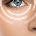 What Type of Anesthesia is Used During LASIK Eye Surgery?