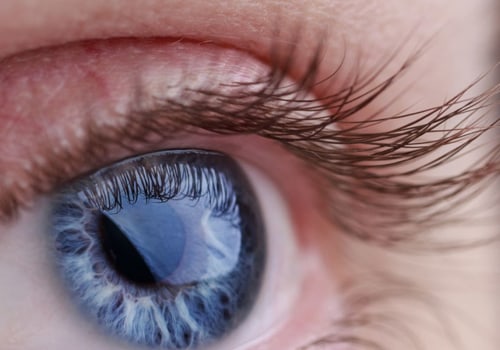 What are the Risks and Side Effects of LASIK Eye Surgery?