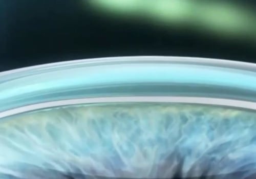 How Common is Undercorrection in LASIK Surgery?