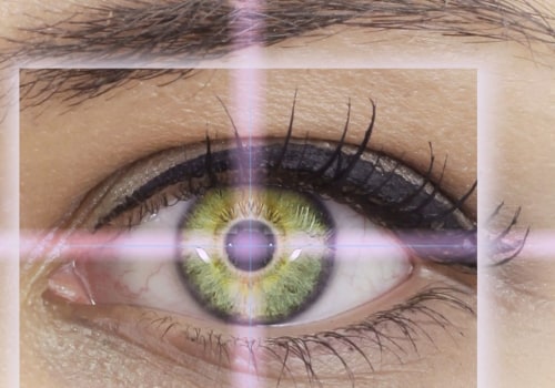 Does LASIK Surgery Last Forever?
