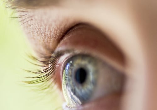 How to Recover from LASIK Eye Surgery: A Comprehensive Guide