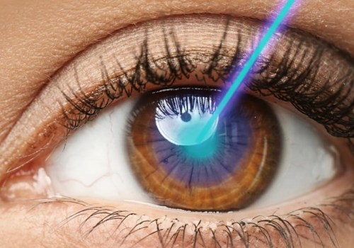 Can Overcorrection After LASIK Be Corrected?