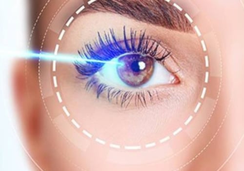 How to Prevent Vision Regression After Lasik Surgery