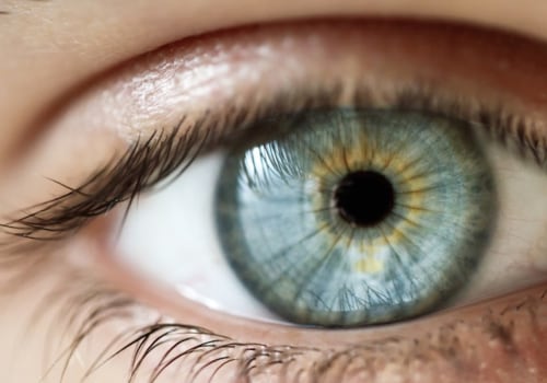 Everything You Need to Know About Lasik Eye Surgery
