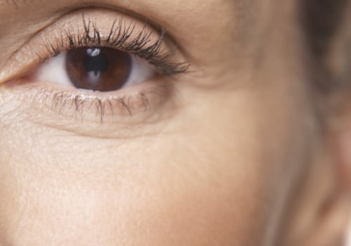 What Are the Age Restrictions for LASIK Eye Surgery?